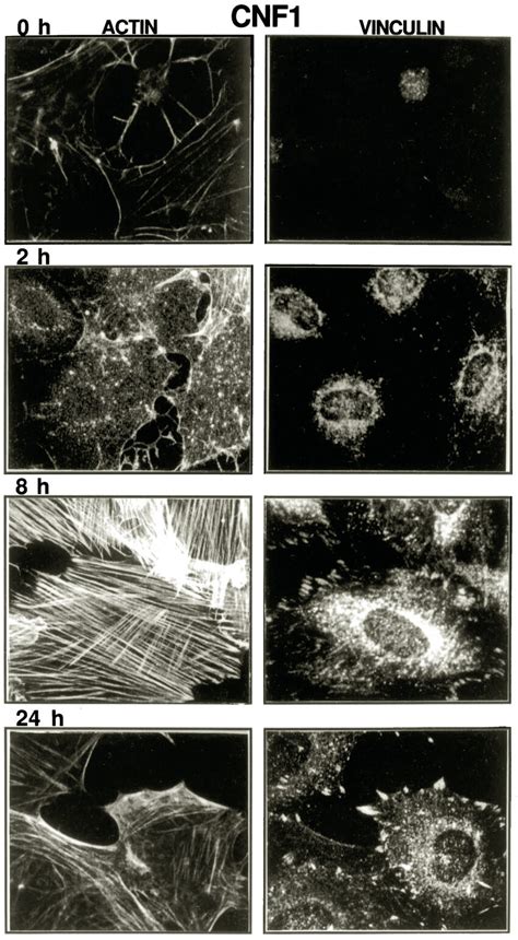 Effect of CNF1 on the actin cytoskeleton and focal contacts. Quiescent ... 