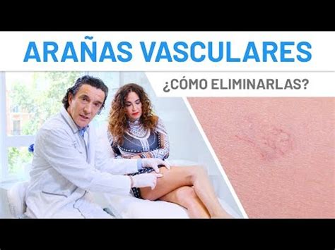 Desvelando los secretos Cómo eliminar de forma efectiva y natural las