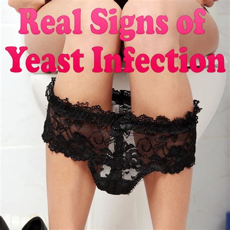 Top 100 Images Photos Of Female Yeast Infection Completed