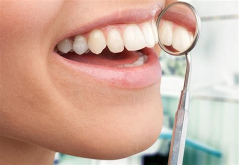 Senhora verificando os dentes no espelho fêmea jovem no consultório do