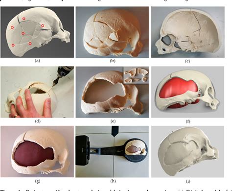 Figure 3 From Analysis Of The Robotic Based In Situ Bioprinting