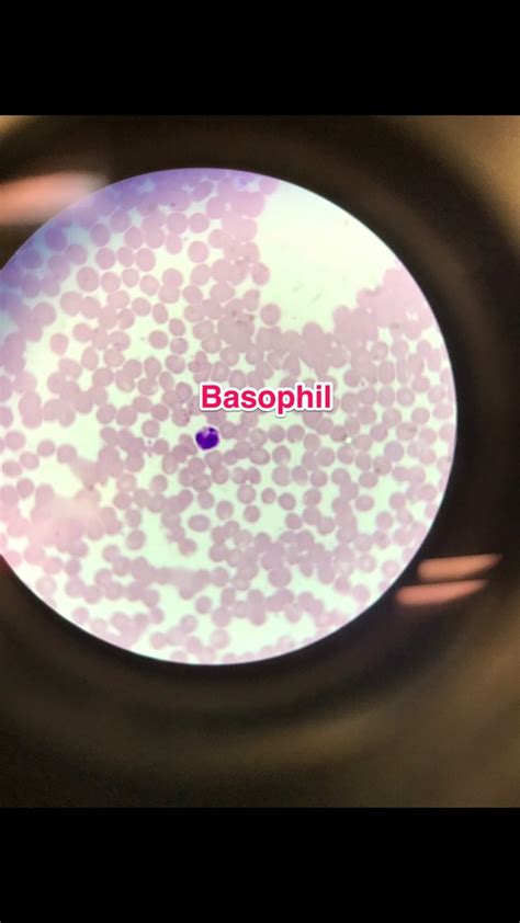 normal blood histology: leukocytes Diagram | Quizlet