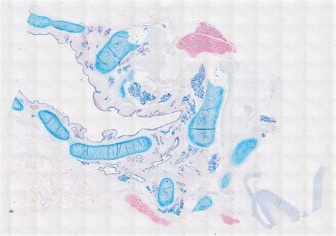 Alcian Blue Staining Of 31 Year Old Human Donor 10