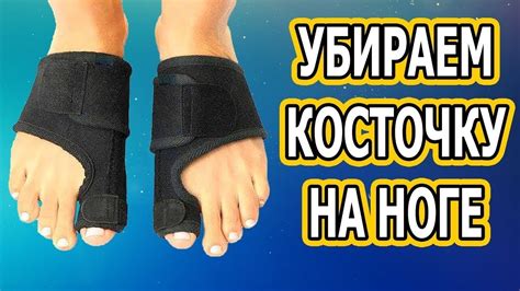 Магнитная вальгусная шина MagnetFix. Обзор шины против косточки на ноге ...