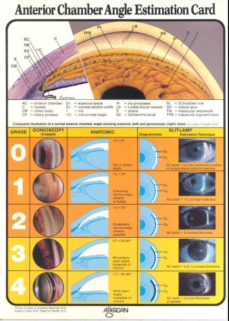 Anterior Chamber Angle