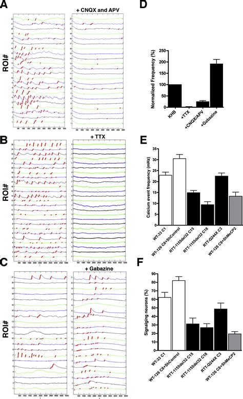 A Model For Neural Development And Treatment Of Rett Syndrome Using