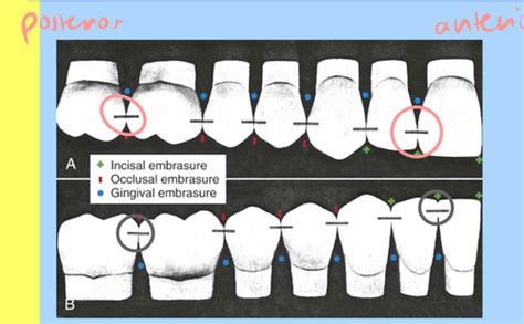 Anterior Teeth Quizlet Flashcards Quizlet