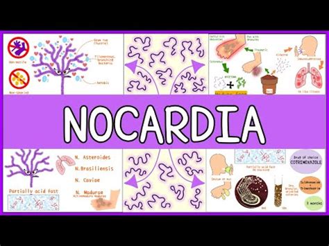 Nocardia brasiliensis: characteristics, morphology, diseases - science ...