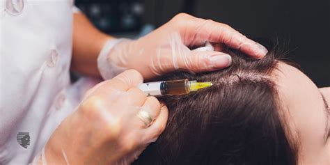 How Prp Treatment Is Effective For Hair Loss Ahs India