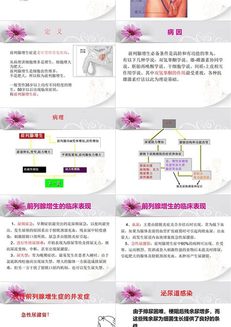 前列腺增生疾病的护理查房案例ppt模板卡卡办公