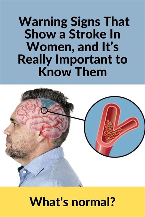 9 Warning Signs That Show A Stroke In Women And Its Really Important