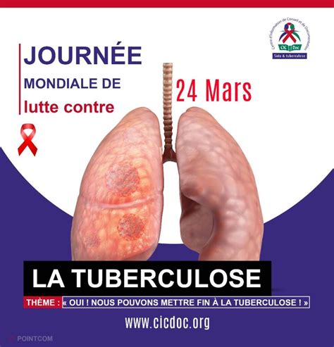 Journée Mondiale De Lutte Contre La Tuberculose Cicdoc