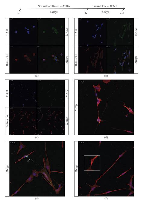 Effect Of Sequential Treatment Of ATRA And BDNF On SH SY5Y A