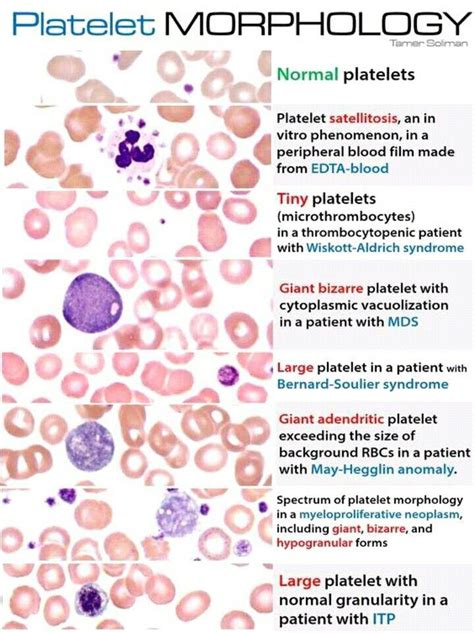 Morphology of platelet | Medical technology, Medical laboratory science ...