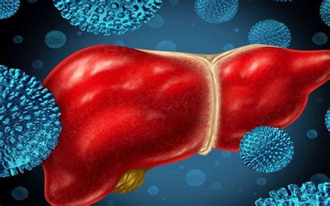 Apa Itu Hepatitis Akut Kenali Gejala Dan Cara Mencegahnya Kanal News