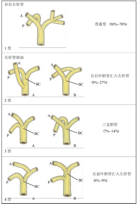 胆管分支的解剖 肝门部和肝内胆管癌治疗 医学