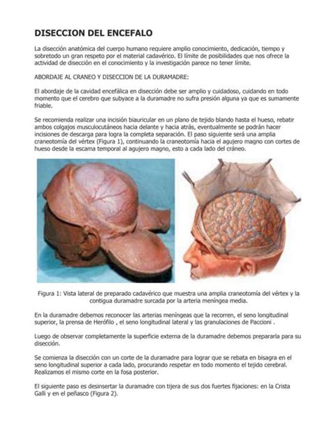 Disección De Cerebro Fin