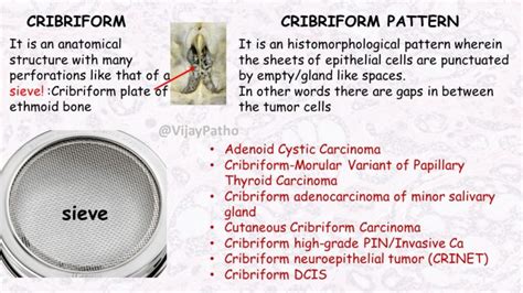 CRIBRIFORM PATTERN : #patternsinhistopathology | Pathology Made Simple