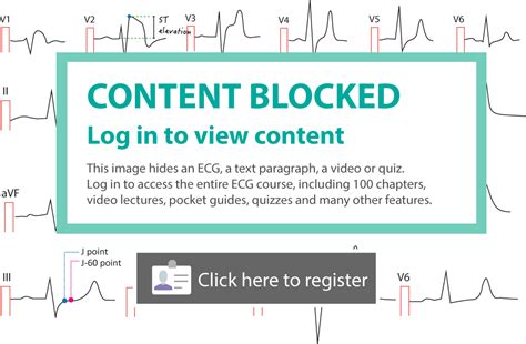 ecg-leads-lead-placement-limb-chest-precordial – ECG learning