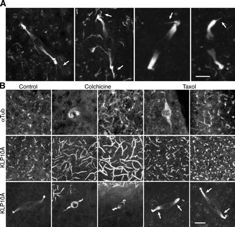 Klp10a Binds To Both Spindle Poles And Cortical Microtubules A