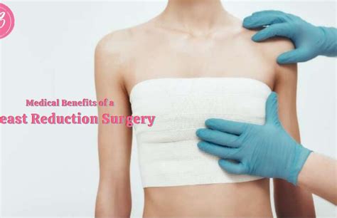 Medical Benefits Of A Breast Reduction Surgery