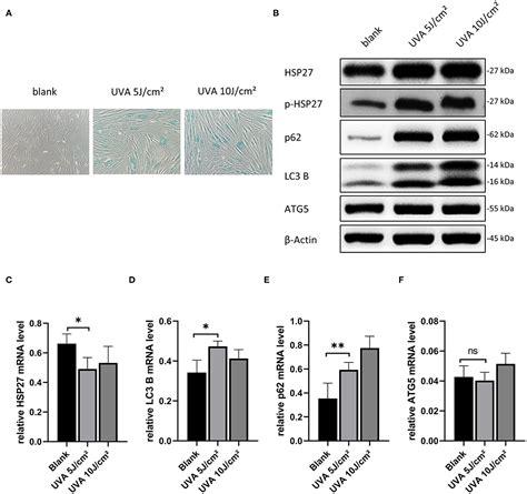 Frontiers Rapamycin Protects Skin Fibroblasts From Uva Induced