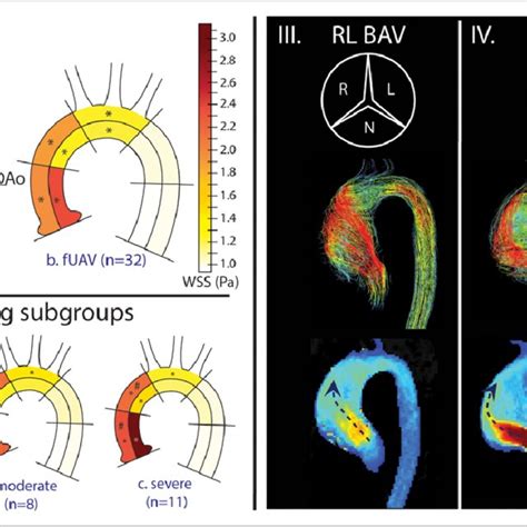 Figure Summary Of Study Results I Ascending Aorta Aao Regions