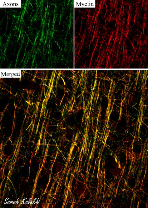 Myelinated Axons in the Cerebral Cortex – You Can Do It!