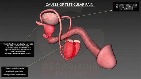 Testicular Pain: Causes, Treatment, And Diagnosis, 45% OFF