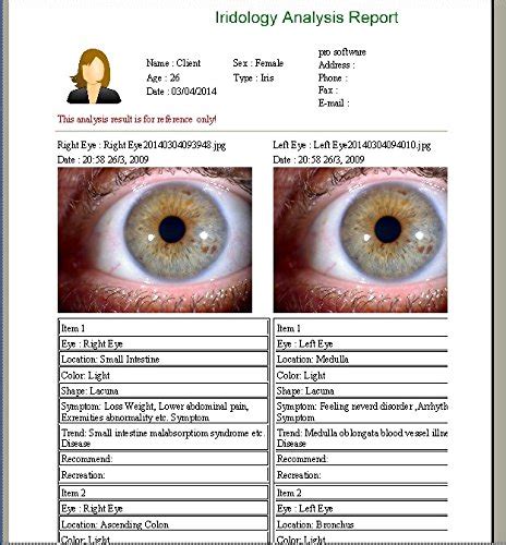 Iridology Chart How To Read Ponasa