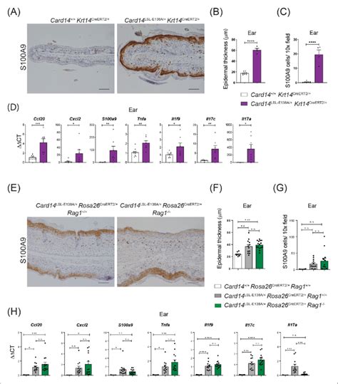 Card14 E138a Signalling In Keratinocytes Induces Ear Skin Inflammation