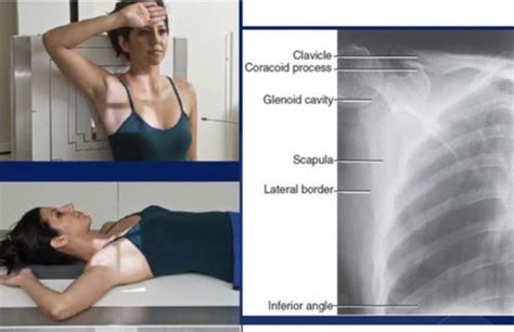 Scapula Clavicle And Ac Joints Flashcards Quizlet