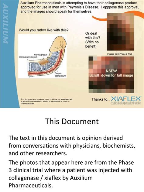 Is Collagenase The Proper Treatment For Peyronie's Disease? | Atheroma ...