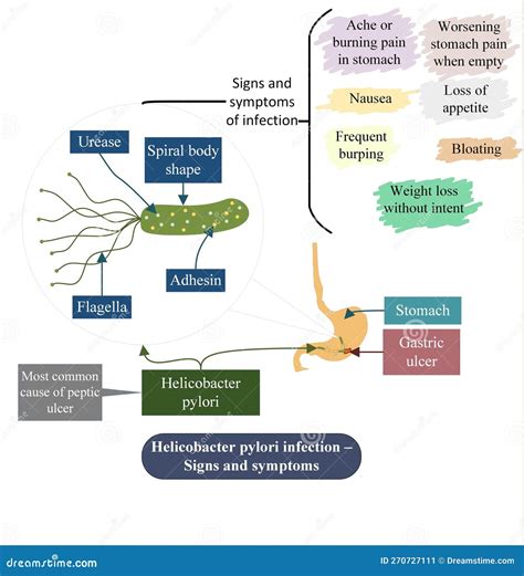 Infection With Helicobacter Pylori Infographics Cartoon Vector