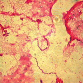 Comparison of genome maps of Bordetella pertussis and Bordetella... | Download Scientific Diagram