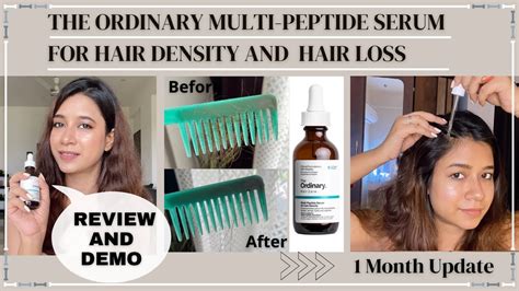 The Ordinary Multi Peptide Serum For Hair Density Review Hair Loss Hairgrowth Viral Youtube