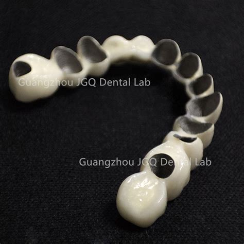 Pfm Porcelain Fused Metal Metal Dentures Co Cr Alloy With