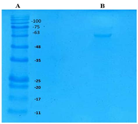 Sds Page Of The Purified Tannase Lane A Protein Markers Lane B