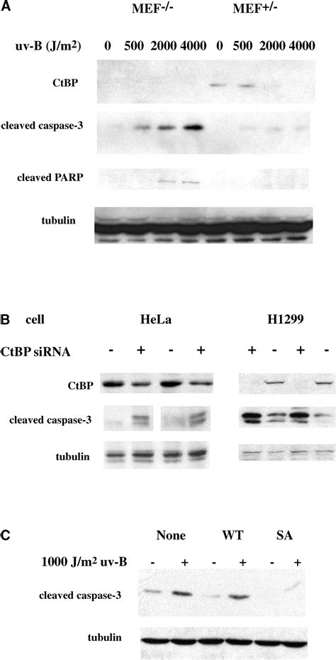 Homeodomain Interacting Protein Kinase 2 Promotes Apoptosis By