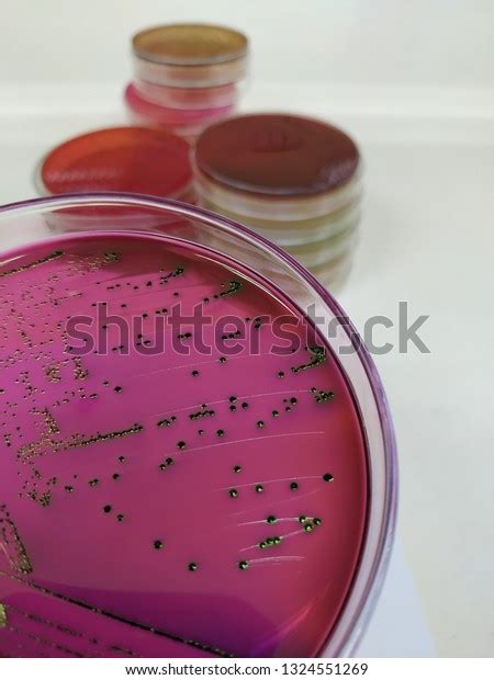 Escherichia Coli Grow Emb Agar Shutterstock