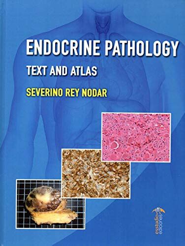 Endocrine Pathology Text And Atlas Rey Nodar Severino