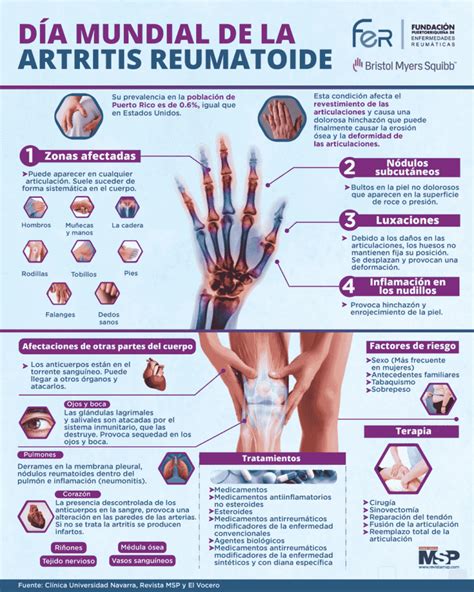 Artritis reumatoide Infografía Ortopedia Goldschmied