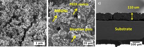 A As Synthesised Mesoporous Bioactive Glass Nanoparticles Mbgns B Download Scientific