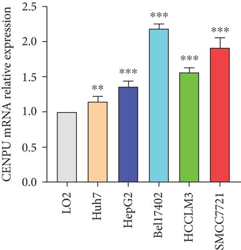 Cenpu Expression In Hcc Tissues And Cell Lines A B Cenpu Mrna And