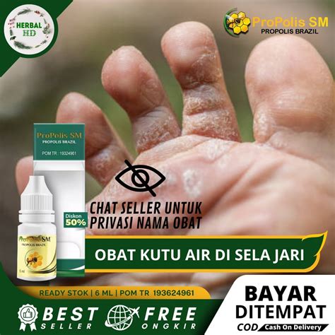 Jual Obat Kutu Air Obat Kutu Air Di Kaki Obat Kutu Air Gatal Di Sela