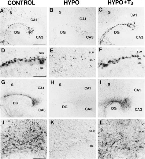 Reelin Rna Af And Protein Gl Expression In Hippocampal