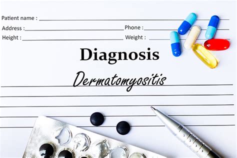 Dermatomyositis – causes, side effects and treatments at NaturalPedia.com