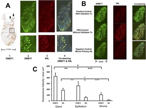 A Colocalization Of Dmbt And S L In Nasal Polyp Tissue Tissue Was