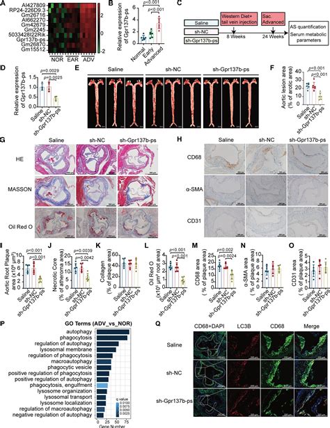 Long Noncoding RNA Gpr137b Ps Promotes Advanced Atherosclerosis Via The