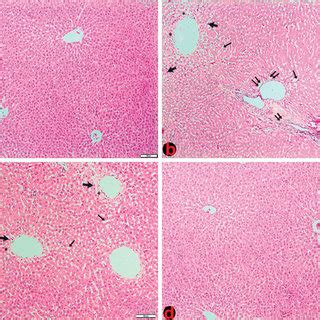 Microscopic View Of The Histopathological Changes Observed In Liver